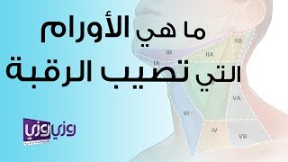 ما هي الأورام التي تصيب الرقبة