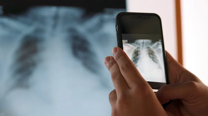 Stanford researchers create algorithm to interpret...