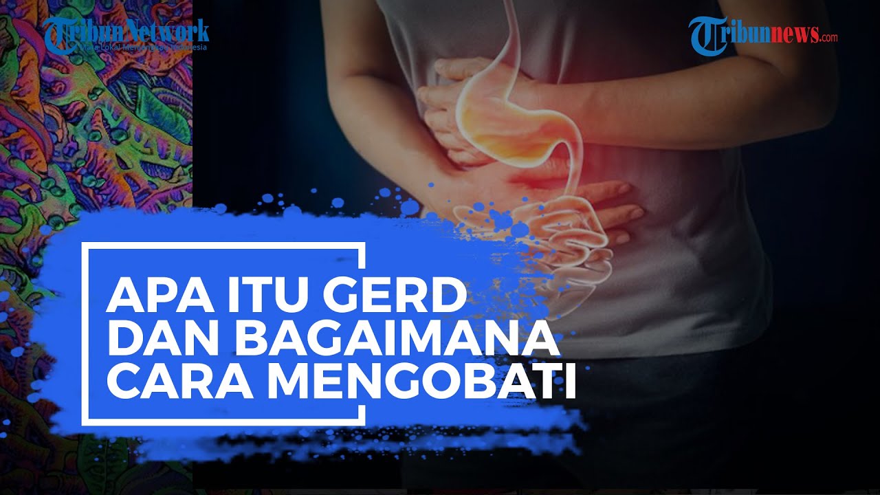 Apa Itu GERD dan Bagaimana Cara Mengobati?