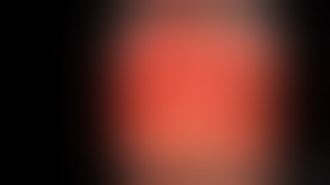 OTSC application for bleeding duodenal ulcer