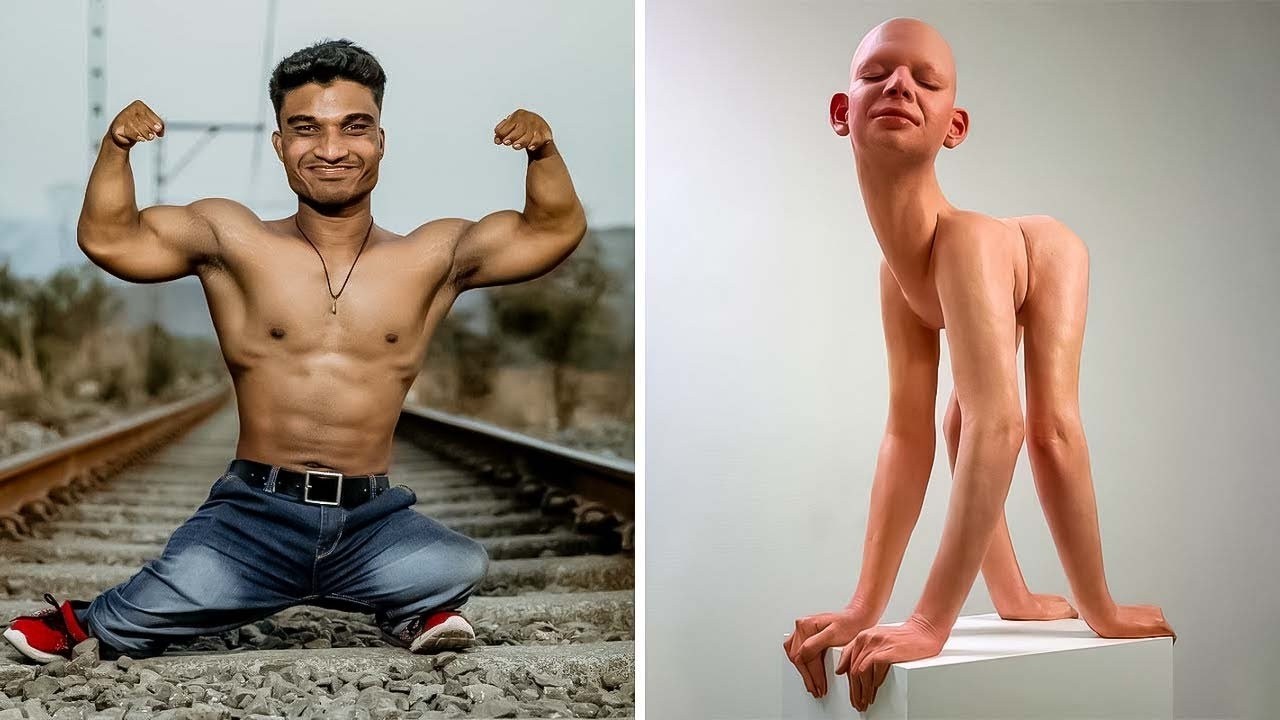 Pessoas Com Características Únicas Que Existem de Verdade