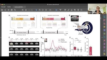 Neuroccino 31st October 2022 - In vivo direct imaging of activity at high temporospatial resolution