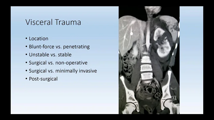2016 AOCR Radiology Case Review: Interventional Ra...