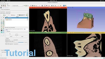 Tutorial: How to use Biomedisa’s Smart Interpolation in 3D Slicer