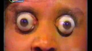 キム グッドマンの目玉画像やプロフィールは ギネス記録で12mm眼球が飛び出す