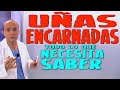 UÑAS ENCARNADAS - Todo lo que necesita saber - Enfermedades #13