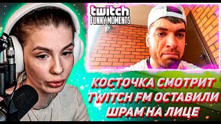 КОСТОЧКА СМОТРИТ ТВИЧ ФМ Топ Моменты с Twitch | Оставили Шрам на Лице