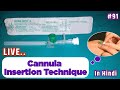 cannula insertion technique in hindi | cannulation technique | कैनुला लगाने का सही तरीका [ 2020 ]