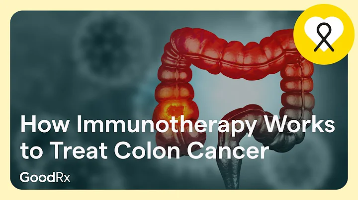 How Immunotherapy Works to Treat Colon Cancer | GoodRx