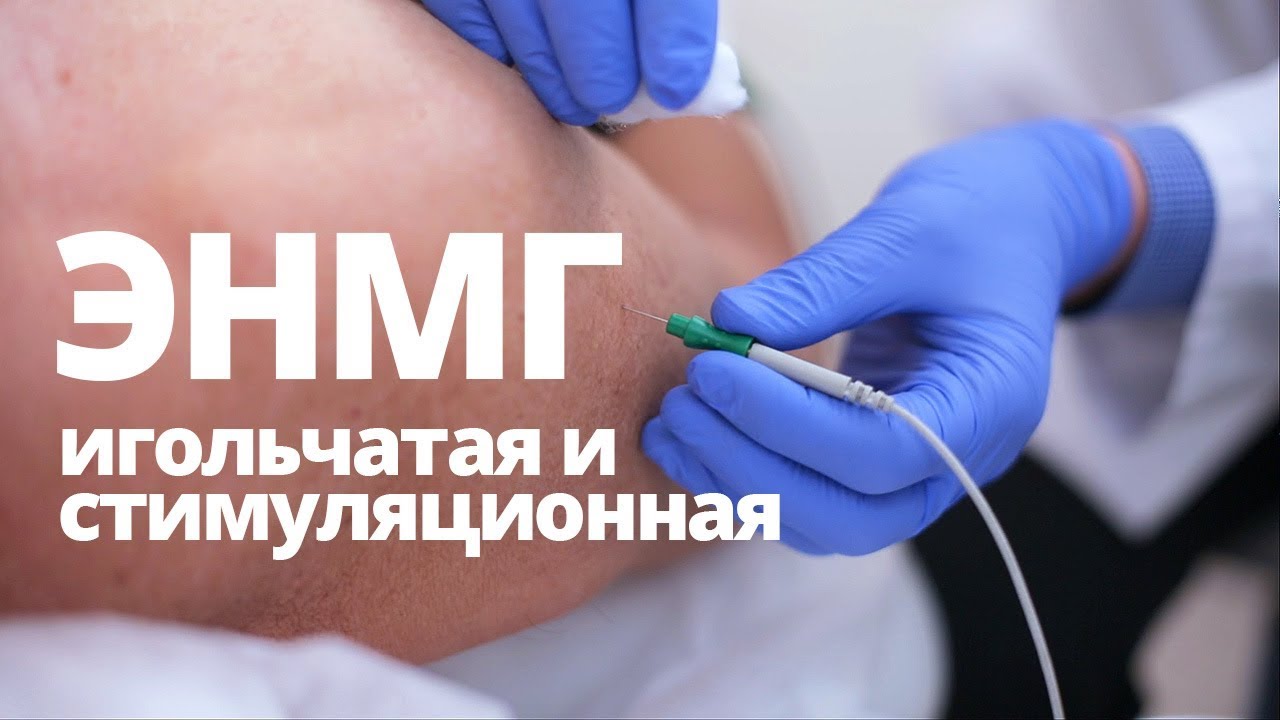 ЭНМГ - основные методики. Что показывает миография? Когда назначается?