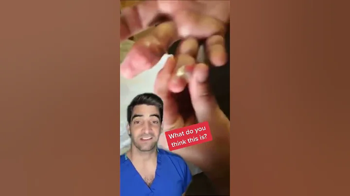 Gout in the finger - DayDayNews