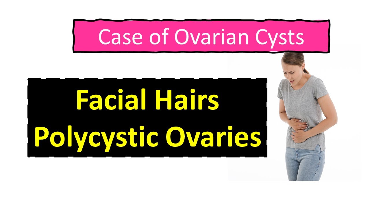Facial Hairs Polycystic Ovaries Spotting between Menses irregular