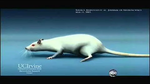 Medical Breakthrough: First Stem Cell Procedure