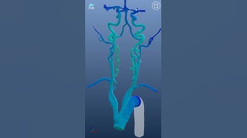 [#E8IGHT Bio] Blood flow simulation #NFLOW