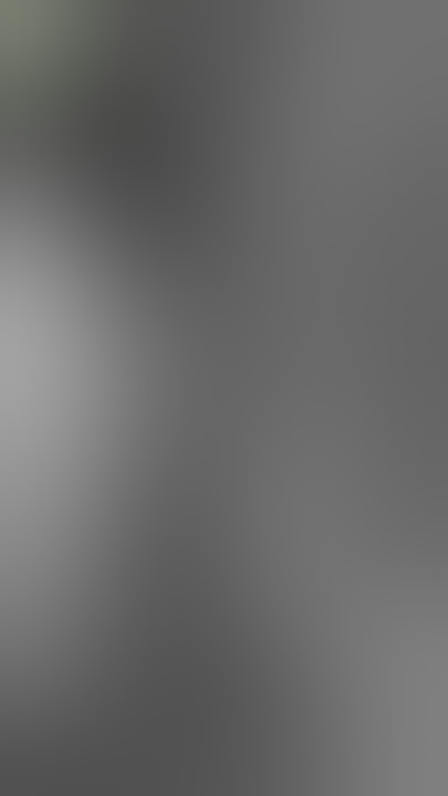 MTF (Male to Female) Sex Reassignment Vagina Creation Surgery with Sigmoid Colon | Vagina Dilation