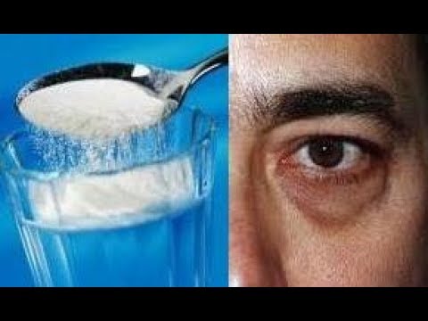 Hilangkan Kantung Mata Anda Dengan Air Garam - YouTube