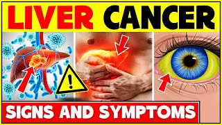 Early Signs And Symptoms Of Liver Cancer: Don't Ignore These Symptoms! - Liver Cancer Symptoms