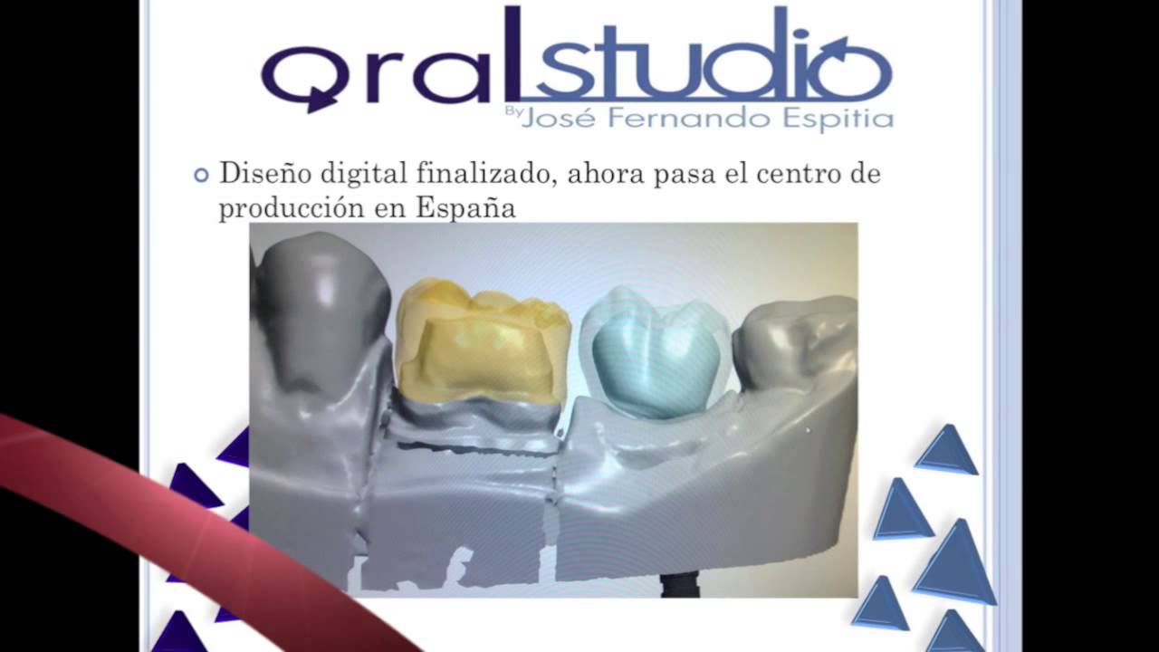 coronas CAD CAM PHIBO - YouTube