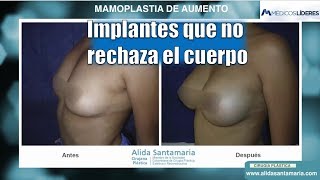 novato ambición Monumento Mamoplastia - Precios 2022 - Aumento de Senos Bogota Medellín Pereira