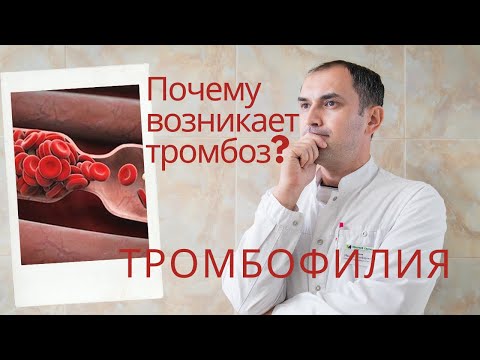 Почему возникает тромбоз? Тромбофилия. Флеболог Москва.