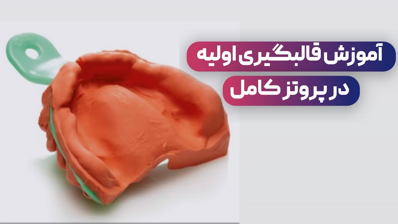 ۲. پروتز کامل -  قالبگیری اولیه