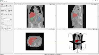 ScanXm tutorial - Basic navigation and visualization Profile