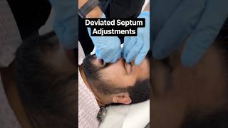 Deviated Septum & Maxillary Sinus Adjustments | Dr. Rahim