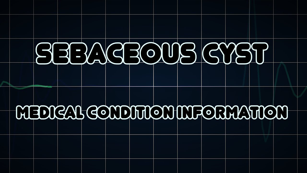 Sebaceous cyst (Medical Condition) YouTube