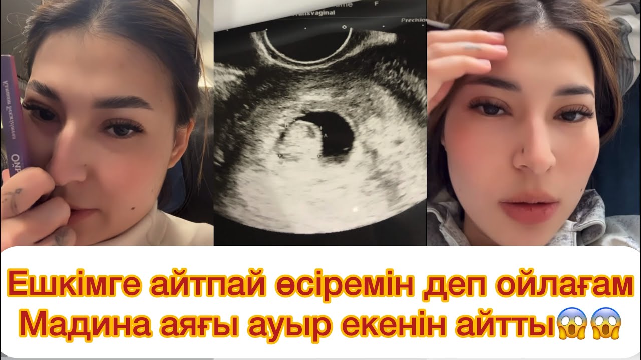 Ешкімге айтпай өсіремін деп ойлағам😱 Мадинаның аяғы ауыр😱