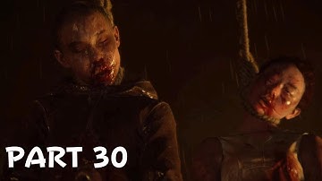 SCARS | THE LAST OF US : PART 2 REMASTERED PS5 | GamePlay WalkThrough | PART 30