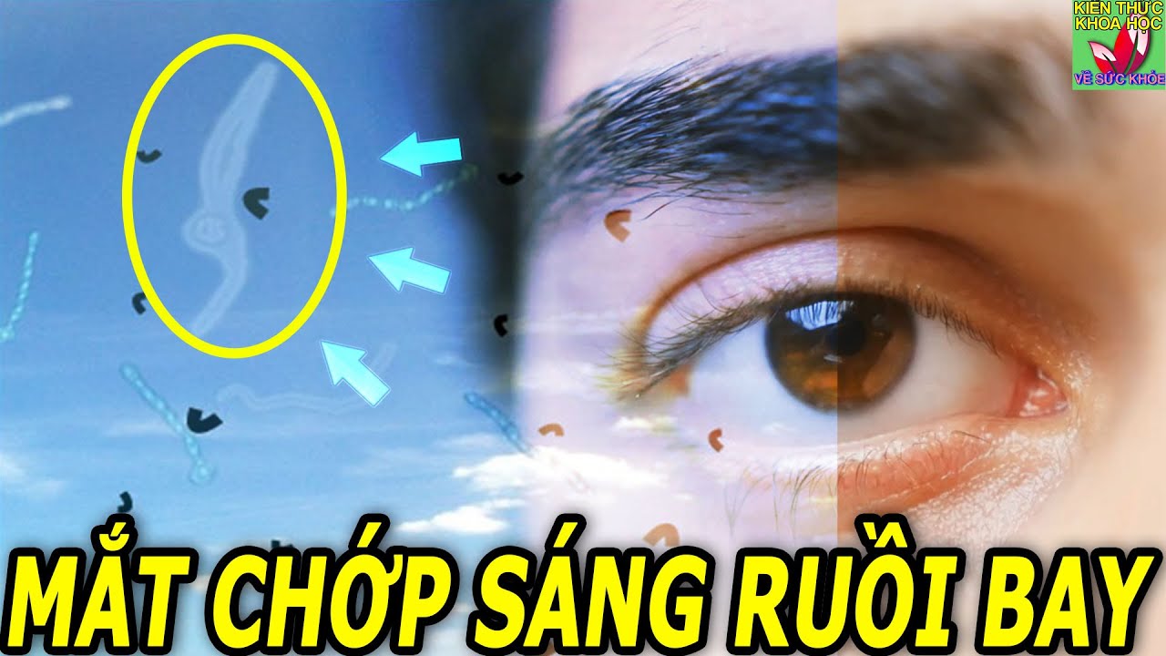 Eyes see flashes of light with black spots or floating hairs - youtube