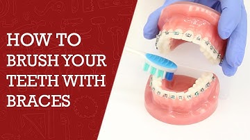 How to Brush Teeth with Braces | Orthodontics Tips #braces #teeth