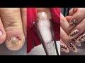 Gel Nail on Short and Chipped Nails | Relaxing Manicure #asmr