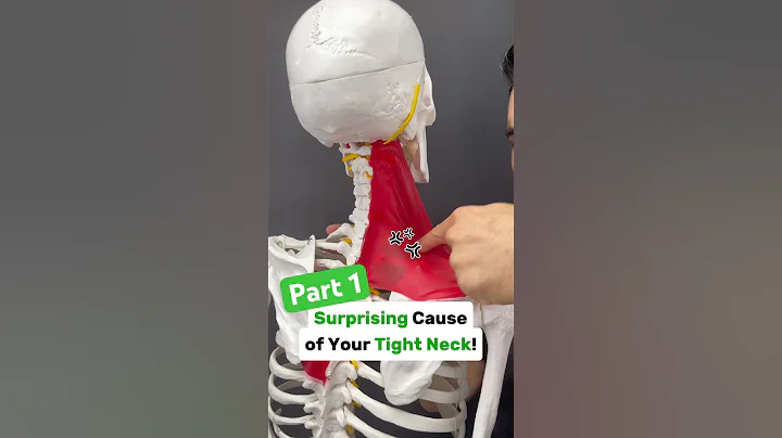 Part 1/2: Is your neck tight with shoulder blade or arm pain? Try this! #neckpain #shoulderpain #tmj