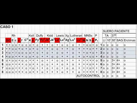 Vídeo: Un Perfil Completo De Proteómica Identifica NRP1 Como Un Nuevo Marcador De Identidad De Vesículas Extracelulares Pequeñas Derivadas De Células Del Estroma Mesenquimatoso De Médula