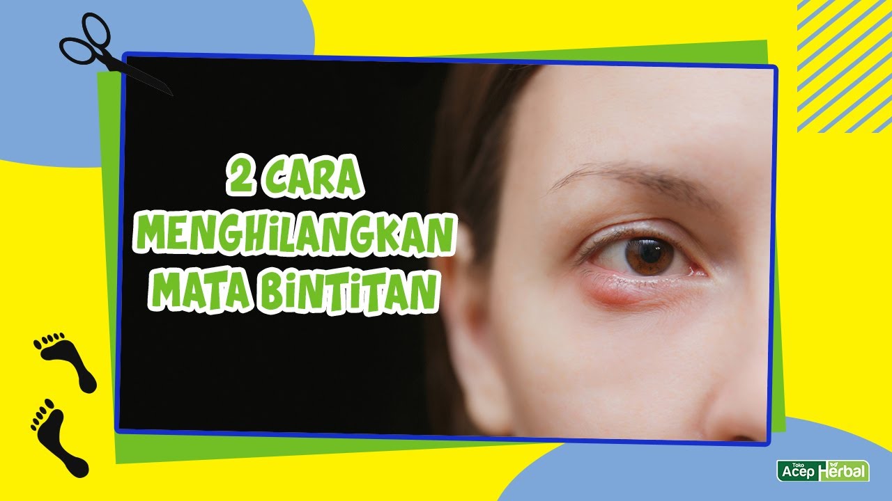 2 Cara Mengobati Mata Bintitan Dengan Bahan Alami yang Harus Anda