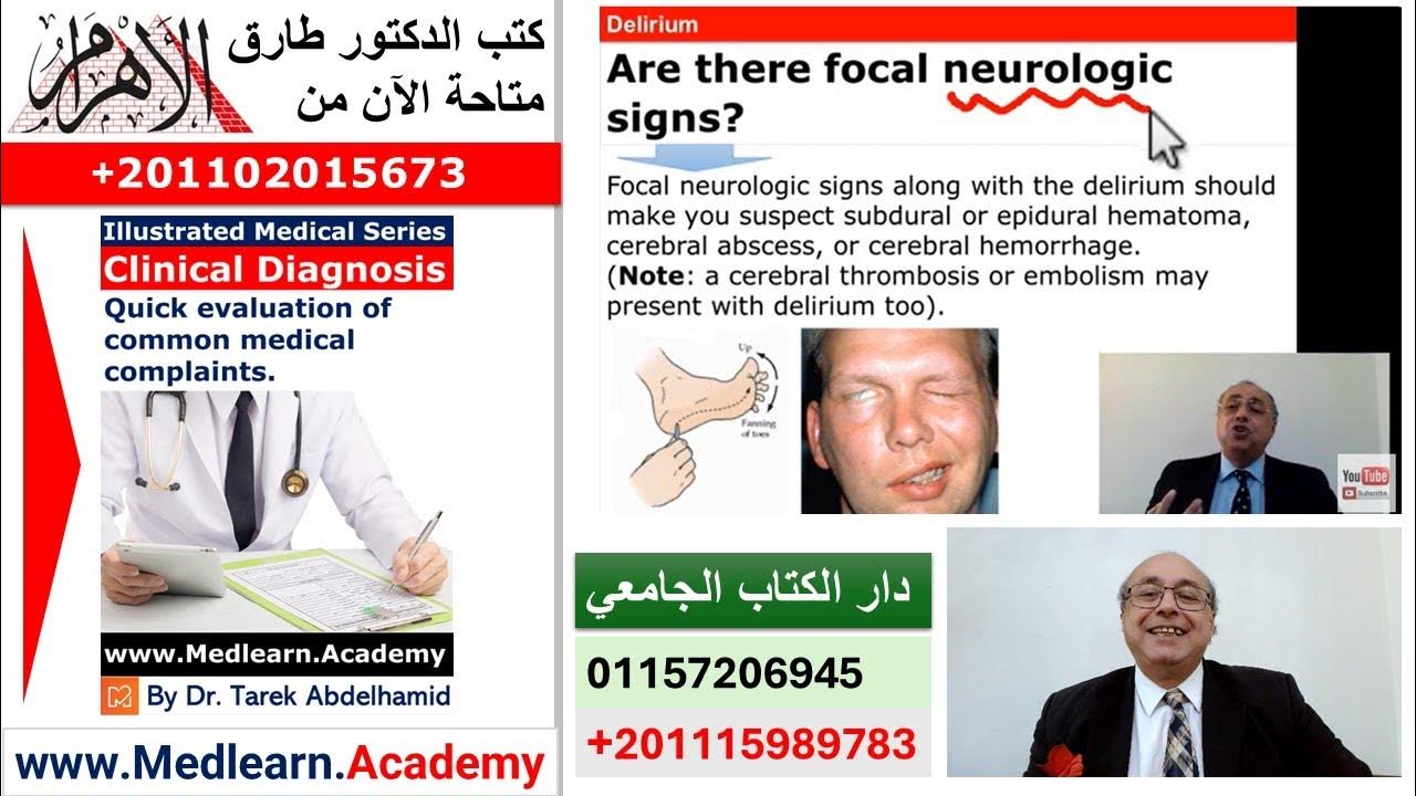 Delirium usmle internal_medicine cme محاضرات_باطنة medicine YouTube