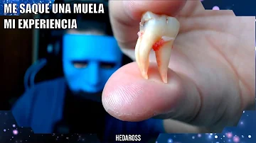 ¿Es más fácil extraer un diente endodonciado?