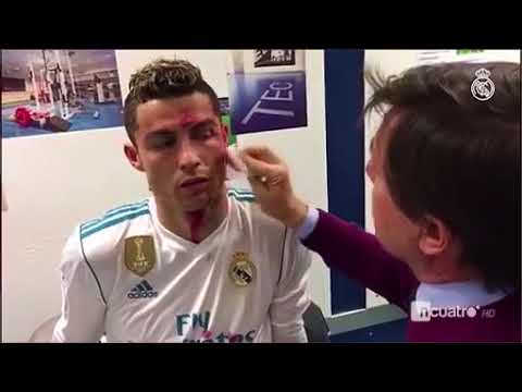 Video: Sie Brechen Cristiano Ronaldos Gesicht