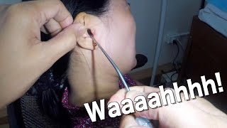 Something Black Stuck in Woman&#39;s Ear | What is It?