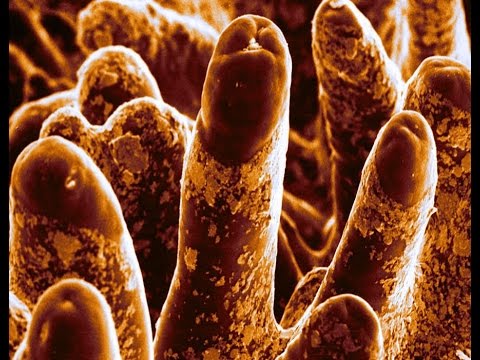 Video: Infezione Batterica Dell'intestino Tenue Negli Uccelli