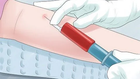 ¿Tiene el hierro bajo durante la menstruación?