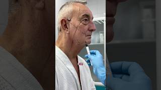 Решился на операцию в 67 лет😎 Пластический хирург НИКОЛАЕВА САНДАРА АФАНАСЬЕВНА