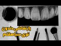 راز نقاشی دندان در سیاهقلم آموزش نقاشی دندان 