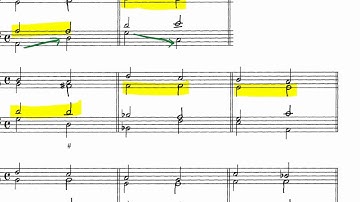 Open & Close Structure Root Position Triad worksheets Video