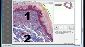 Module 3 Quiz Part B VideoReview