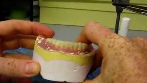 Deflasking and Trimming