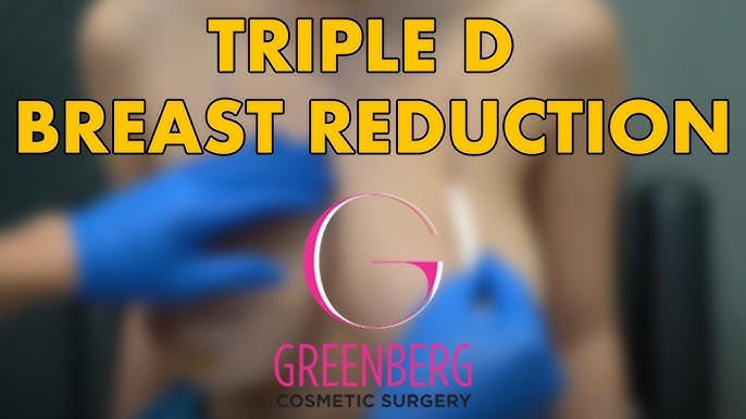 Breast Reduction (TRIPLE D BREASTS)