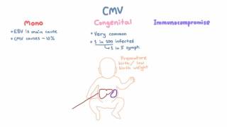 CMV Clinical Syndromes - Mono, Congenital Infection, Immunocompromised Hosts