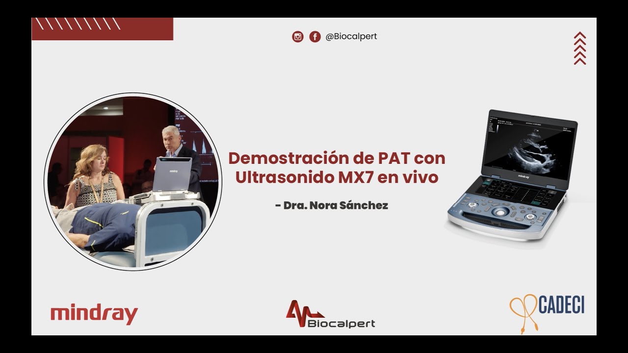 DEMOSTRACIÓN ULTRASONIDO MX7